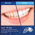 MagicBrite Complete Teeth Whitening Kit At Home Whitening